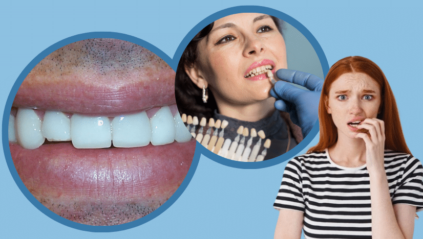 What Happens if My Porcelain Veneer Gets Chipped or Cracked