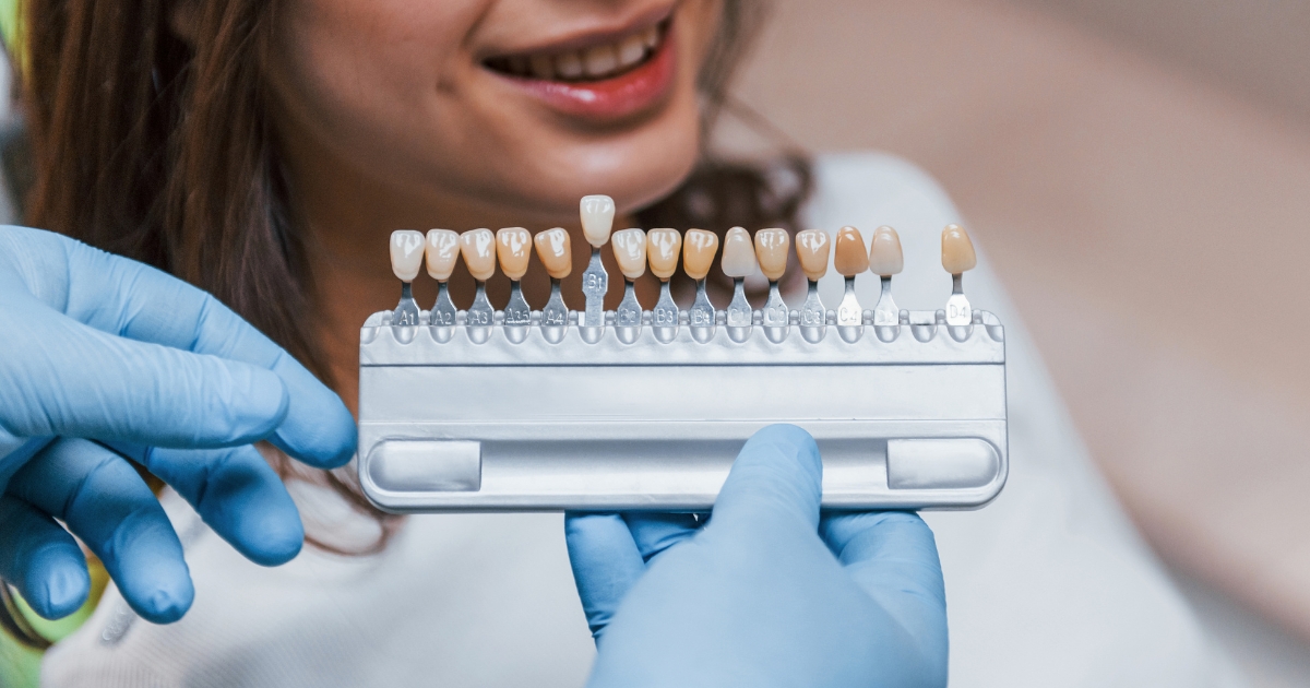 misconceptions about dental veneers