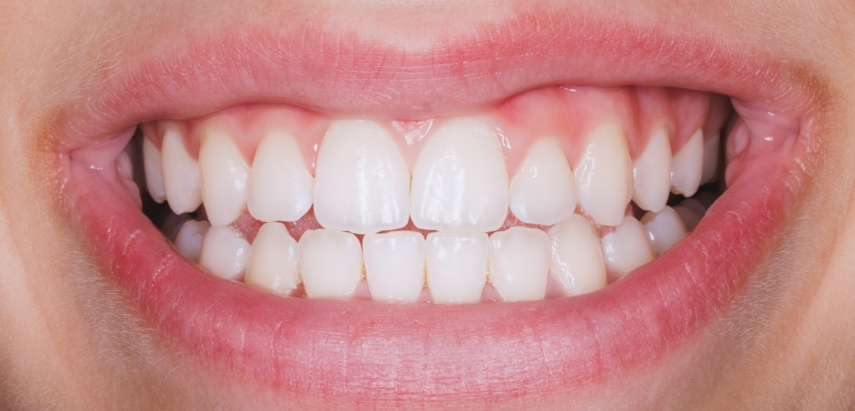 protect your gums from thanksgiving irritation what to avoid and how to care for them